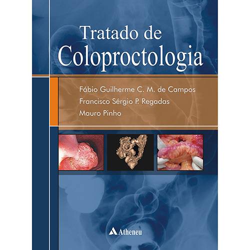 Livro - Tratado de Coloproctologia