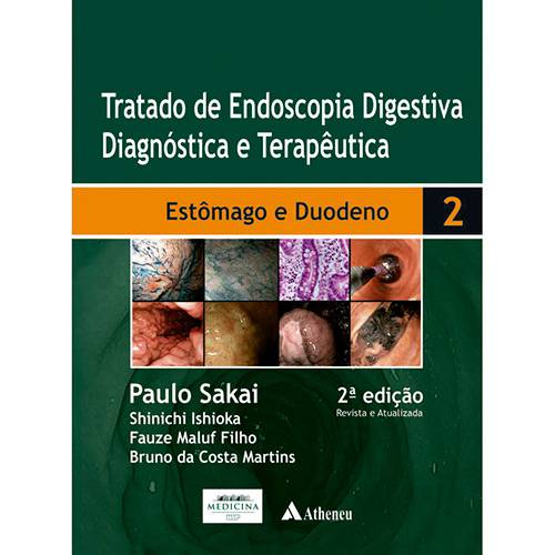 Livro - Tratado de Endoscopia Digestiva: Diagnóstica e Terapêutica - Estômago e Duodeno - Vol. 2