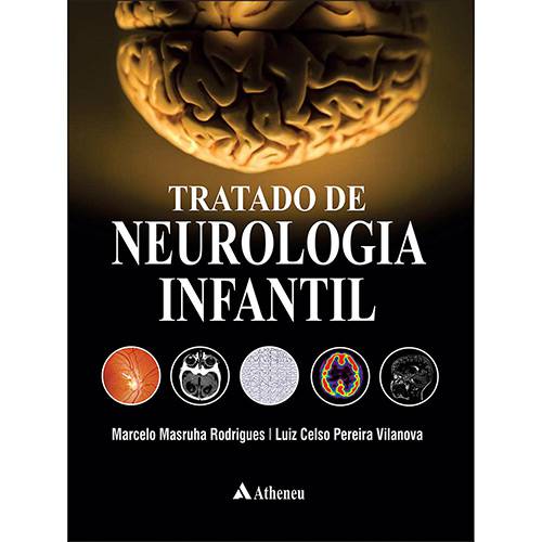 Livro - Tratado de Neurologia Infantil