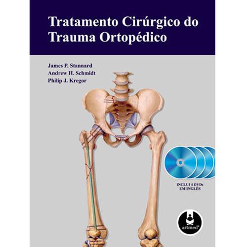 Livro - Tratamento Cirúrgico do Trauma Ortopédico
