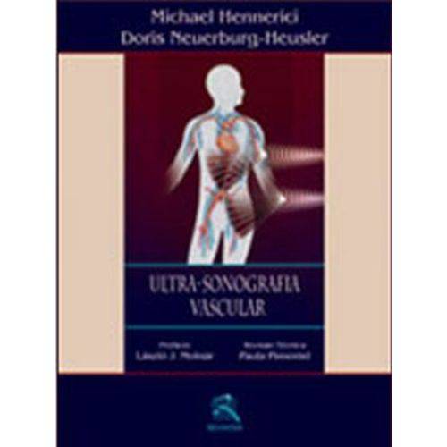 Livro - Ultra-sonografia Vascular - Hennerici