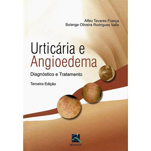 Livro - Urticária e Angioedema: Diagnóstico e Tratamento