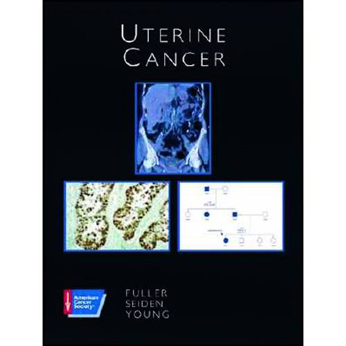 Livro - Uterine Cancer
