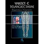 Livro - Varizes e Telangiectasias: Diagnóstico e Tratamento