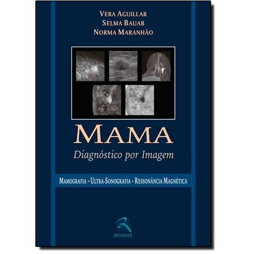 Mama - Diagnóstico por Imagem