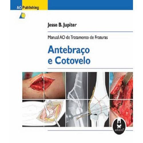 Manual ao de Tratamento de Fraturas - Antebraco e Cotovelo