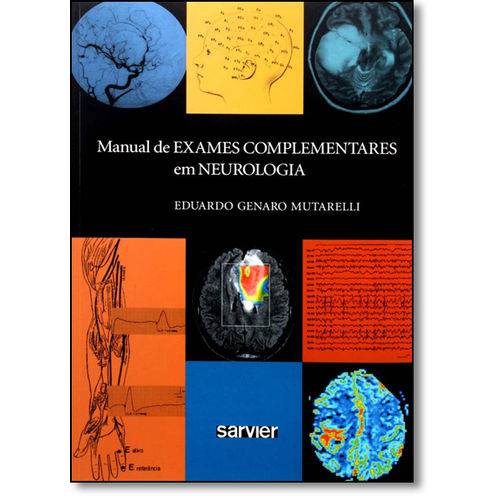 Manual de Exames Complementares em Neurologia