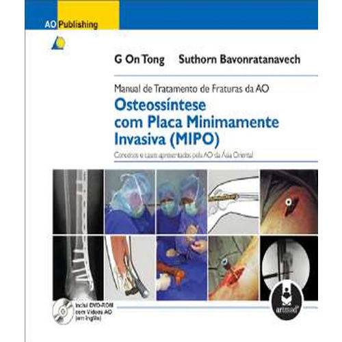 Manual de Tratamento de Fraturas da ao - Osteossintese com Placa Minimamente Invasiva (mipo)