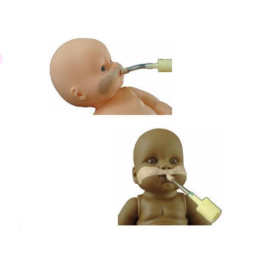 Multfix - Fixador Adesivo para Tubo Endotraqueal Neonatal Individual - Impacto Medical - Cód: Imp19158