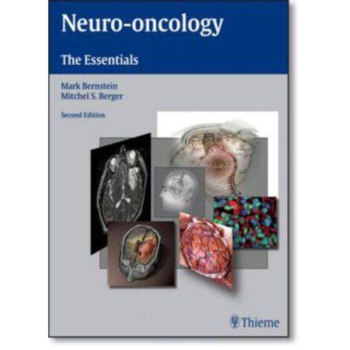 Neuro Oncology: The Essentials
