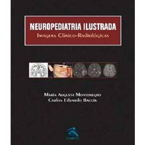 Neuropediatria Ilustrada