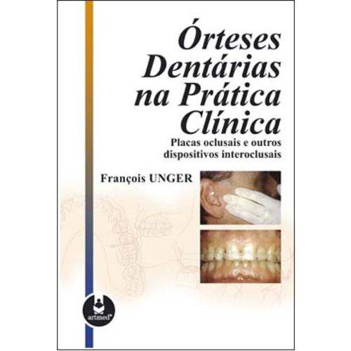 Orteses Dentarias na Pratica Clinica