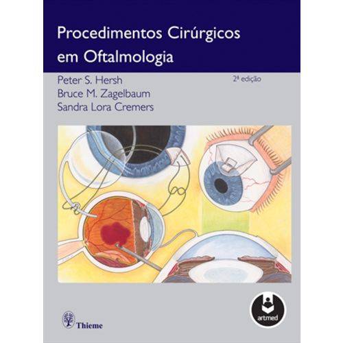Procedimentos Cirurgicos em Oftalmologia - 02 Ed