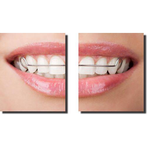 Quadro Decorativo Odontologia Dentista Varias Peças M1