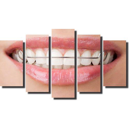 Quadro Decorativo Odontologia Dentista Varias Peças M1