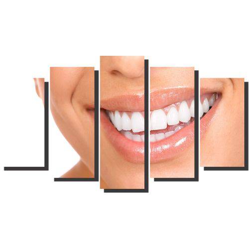 Quadro Decorativo Odontologia Dentista Varias Peças M6
