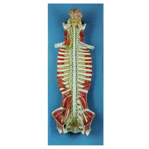 Sistema de Medula Espinhal em Seu Canal - Anatomic - Cód: Tzj-0328-s