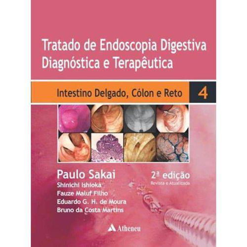Tratado de Endoscopia Digestiva - Intestino Delgado, Cólon e Reto - Volume Iv