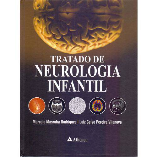 Tratado de Neurologia Infantil - 01ed/17