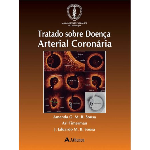 Tratado Sobre Doenca Arterial Coronaria - Atheneu