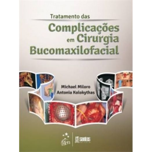 Tratamento das Complicacoes em Cirurgia Bucomaxilofacial - Santos