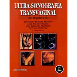 Ultra-Sonografia Transvaginal