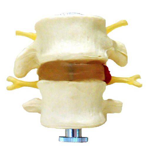 Vértebras Lombares 2 Peças Anatomic - Tgd-0153-a
