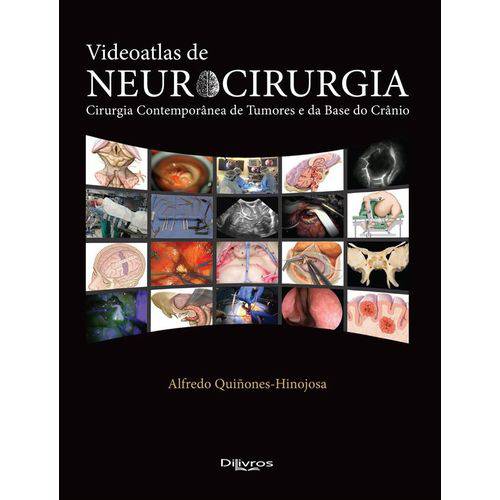 Videoatlas de Neurocirurgia