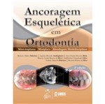 Ancoragem Esqueletica em Ortodontia - Santos