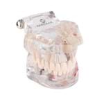 Arcada Dentaria Manequim Odontológico Macromodelo P Estudo e Demonstração
