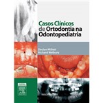 Casos Clínicos de Ortodontia na Odontopediatria