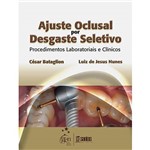 Livro - Ajuste Oclusal por Desgaste Seletivo-Procedimentos Laboratoriais e Clínicos