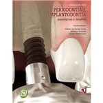 Livro - Avanços em Periodontia e Implantodontia - Paradigmas e Desafios