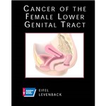 Livro - Cancer Of Female Lower Genital Tract