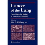 Livro - Cancer Of The Lung - From Molecular Biology To Treatment Guidelines