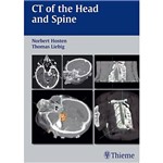 Livro - CT Of The Head And Spine