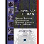 Livro - Imagem do Tórax - Radiologia, Tomografia e Ressonância Magnética