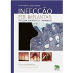 Livro - Infecção Peri-Implantar - Etiologia, Diagnóstico e Tratamento