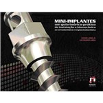 Livro - Mini-Implantes - um Guia Teórico-prático de Instalação e Biomecânica ao Ortodontista e Implantodontista