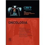 Livro - Oncologia - Série Colégio Brasileiro de Radiologia e Diagnóstico por Imagem
