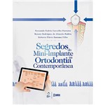 Livro - Segredos do Mini-Implante na Ortodontia Contemporânea