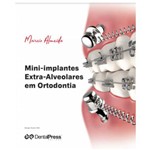Mini-implantes Extra-alveolares em Ortodontia - Marcio Almeida
