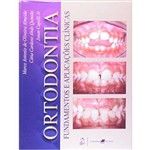 Ortodontia Fundamentos e Aplicações Clínicas