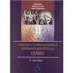 Tomografia Computadorizada e Ressonancia Magnetica do Cranio- 4 Ed