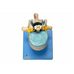 Vértebra Lombar C/Cordão Espinhal, Nervo e Cauda Equina Modelo Anatômico