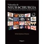 Videoatlas de Neurocirurgia